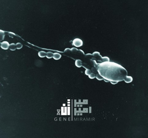 Gene