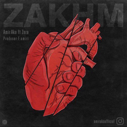 ZAKHM